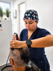 ד"ר קרולינה ב-DNG Medical Esthetics מבצעת טיפול השתלת שיער בקרקפת של מטופל בקליניקה