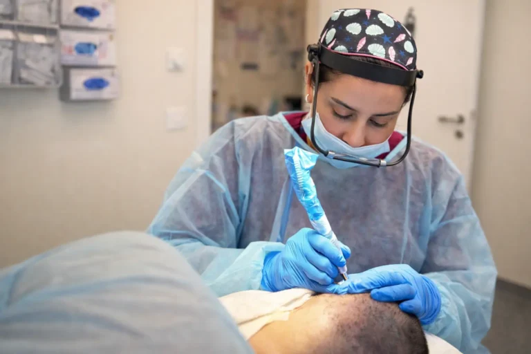 טיפול מיקרונידלינג בקרקפת לעידוד צמיחת שיער