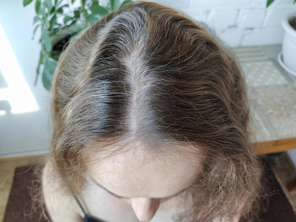 כמה זמן לוקח לשיער לצמוח?