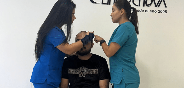 השתלת שיער - איך בחורים רופא להשתלת שיער?