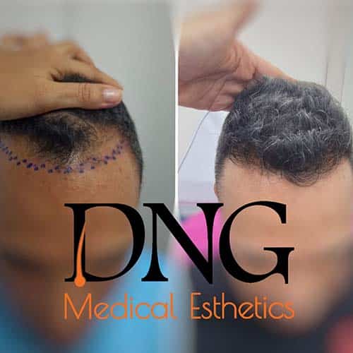 dng4