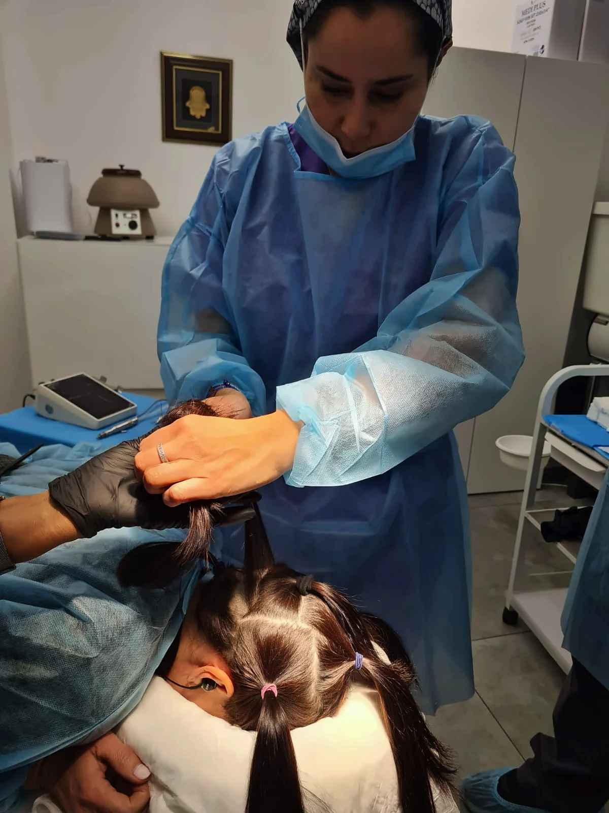 הכנת השיער לפני השתלת שיער לנשים בקליניקת DNG Medical – השתלה ללא גילוח מלא