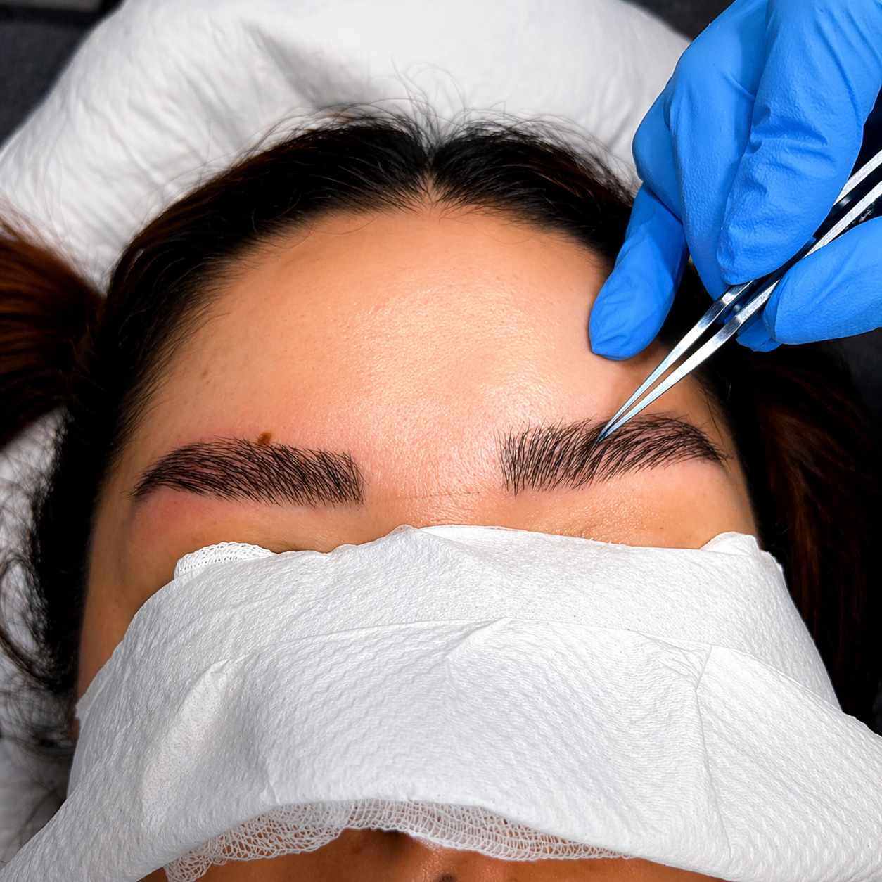 תכנון השתלת גבות לפני טיפול בשיטת DHI