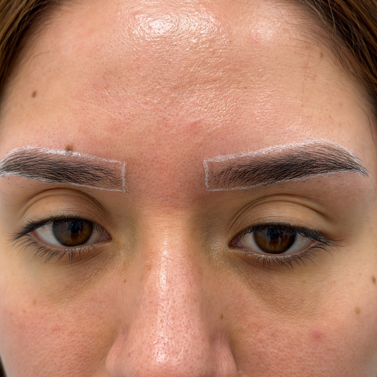 גבות דלילות לפני השתלת גבות